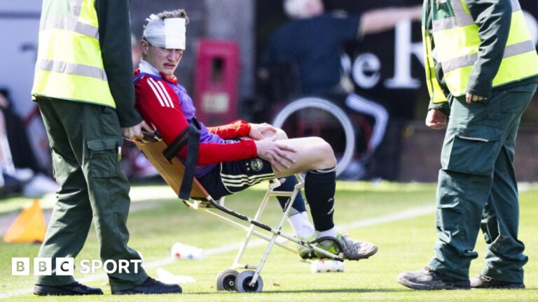 Aberdeen: Jack MacKenzie left bloodied by object thrown by own fans in Dundee Utd defeat