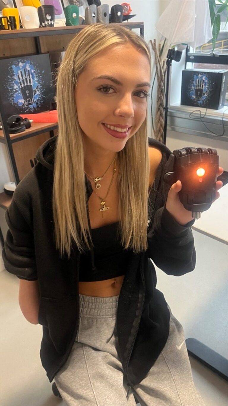 Winnersh teen plans to raise £20,000 to buy a bionic arm